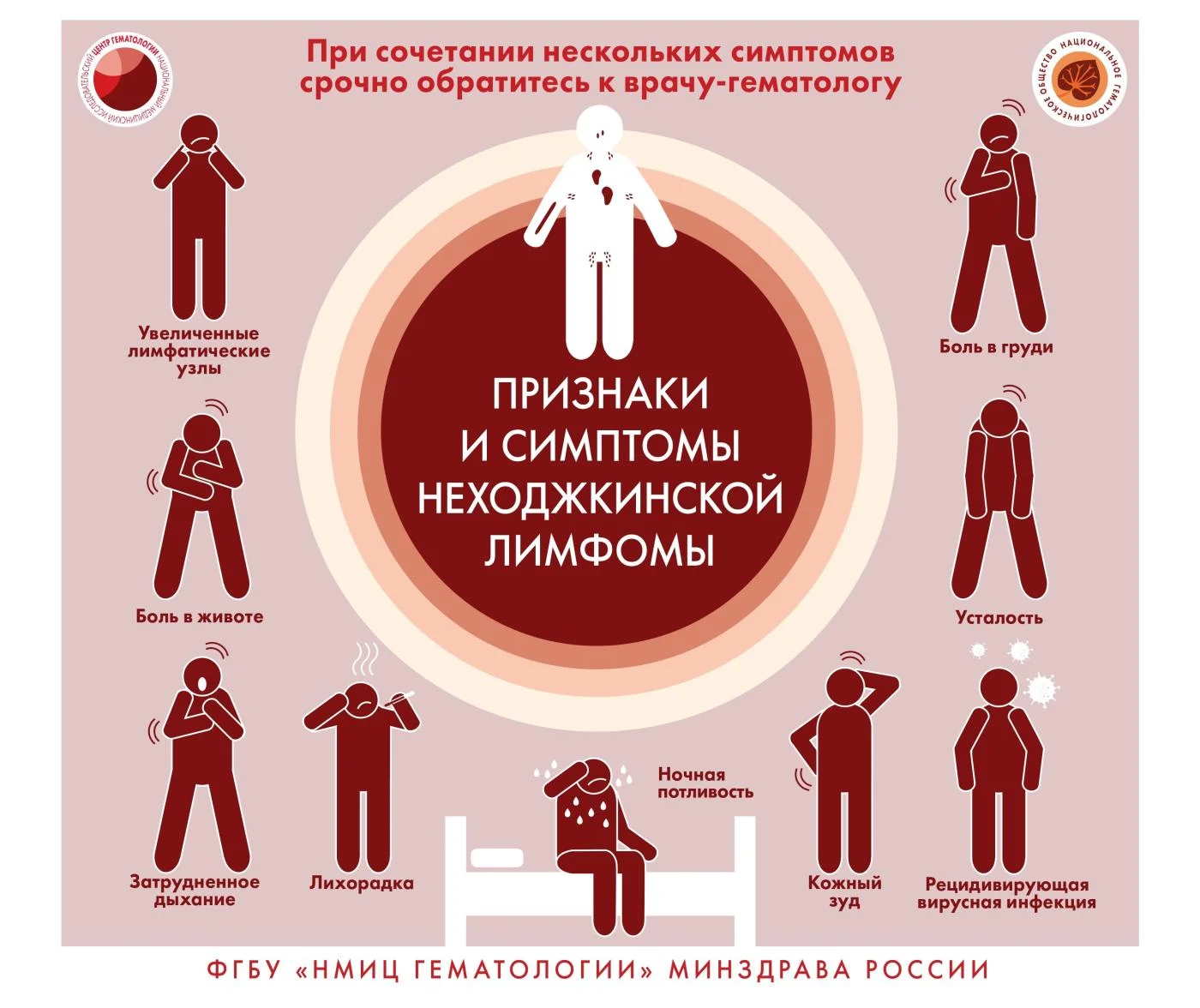 Признаки и симптомы неходжкинской лимфомы