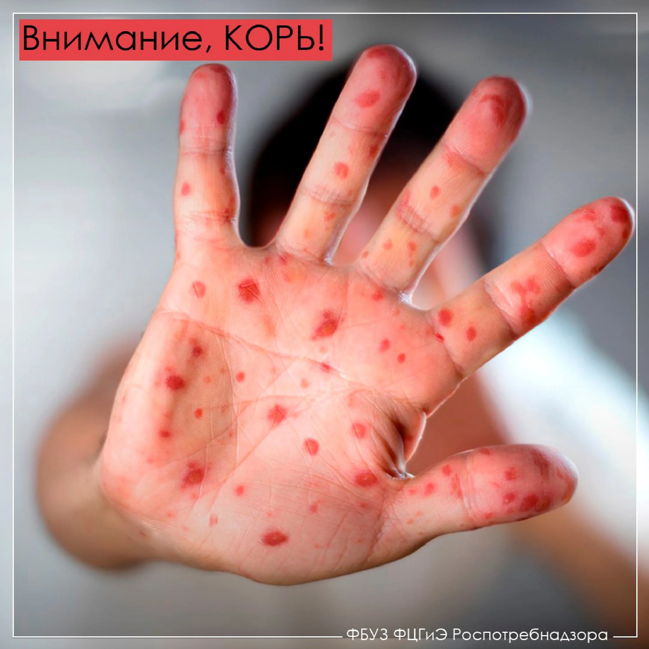 корь_page-0003.jpg