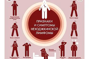 Признаки и симптомы неходжкинской лимфомы